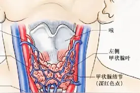 患有甲状腺结节在哪种情况下需要做手术？视频封面