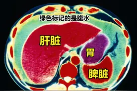 当亲人送入ICU，都会遭受到哪些“酷刑”图片