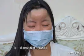 女子和三个孩子被家暴11年，无奈提出离婚，却被丈夫咬掉鼻子图片