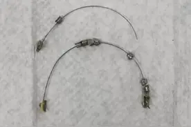 13岁男孩矫牙不成，误吞牙箍弓丝！若穿破胃壁，后果不堪设想图片