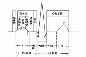 这样教你看心电图，没有理由看不懂图片