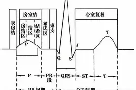 这样教你看心电图，没有理由看不懂图片