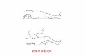 几种常用髋关节病变的诊断手法图片