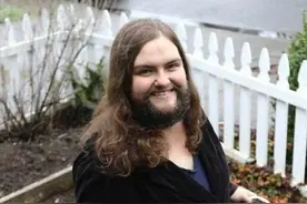 长胡子的女人真性感 女人长胡子是怎么回事图片