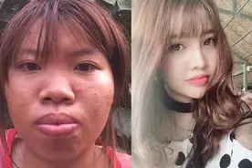丑姑娘花9万整容后嫁给富二代 生了个女儿却很漂亮图片