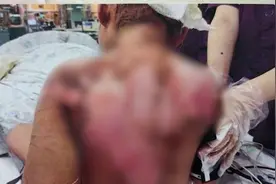 心疼！抚顺6岁被虐女童伤情鉴定结果：体表重伤2级，另有8处轻伤视频封面