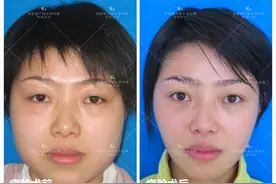 我的助理分享亲身整形经历，给正在追求变美的姐妹们的心里话图片