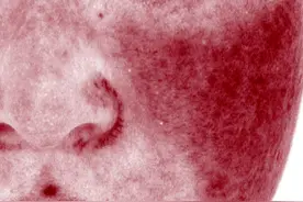 拯救敏感肌大作战！抗敏修复全攻略来了图片