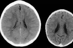 那些经常被打骂的孩子，大脑可能发生这样的变化，家长别不在意图片
