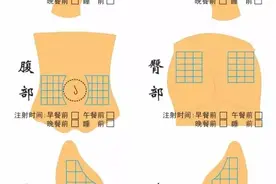 手把手教你制作胰岛素注射部位轮换图，提高胰岛素的疗效，减少注射不良反应图片