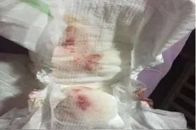 儿科医生提醒：新生儿易出现这些生理现象，爸妈别慌，孩子没生病图片