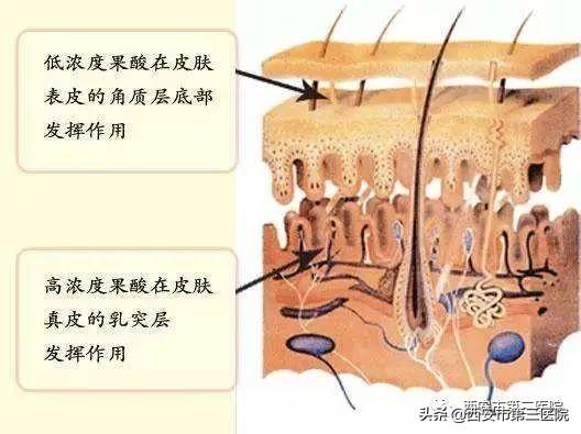 西安治疗鱼鳞病的医院哪家最好