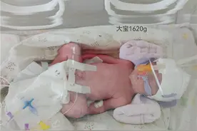 母子平安！全国首例新冠肺炎确诊三胞胎孕妇在瑞丽顺利生产图片