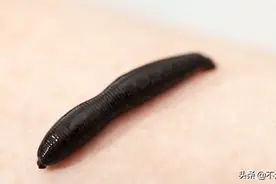 身体误吞蚂蝗，会在体内繁殖吗？被吸血了别慌，这么做图片