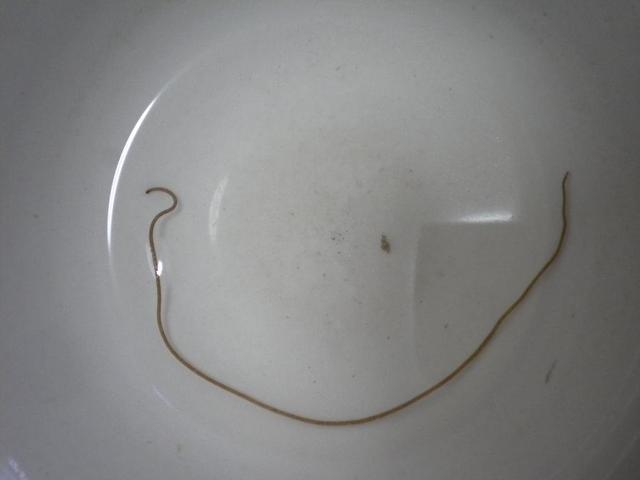 鱼鳞下面的寄生虫鱼可以吃吗