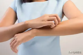 脱衣服后总是发现很多白屑？医生：可能是缺乏这种维生素引起图片
