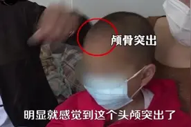 郴州“大头娃娃”涉事公司年销售额过千万，推荐假奶粉医生被停职图片