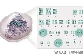 【女性频道】常见染色体病 — 13三体综合征图片