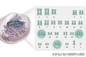 【女性频道】常见染色体病 — 13三体综合征图片