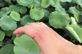 伤害不大侮辱性极强？浙江男子钓鱼反被鱼咬出血，什么鱼这么凶？图片