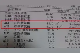 转氨酶高是什么原因导致的？多半和这5个因素有关，早知道早预防图片
