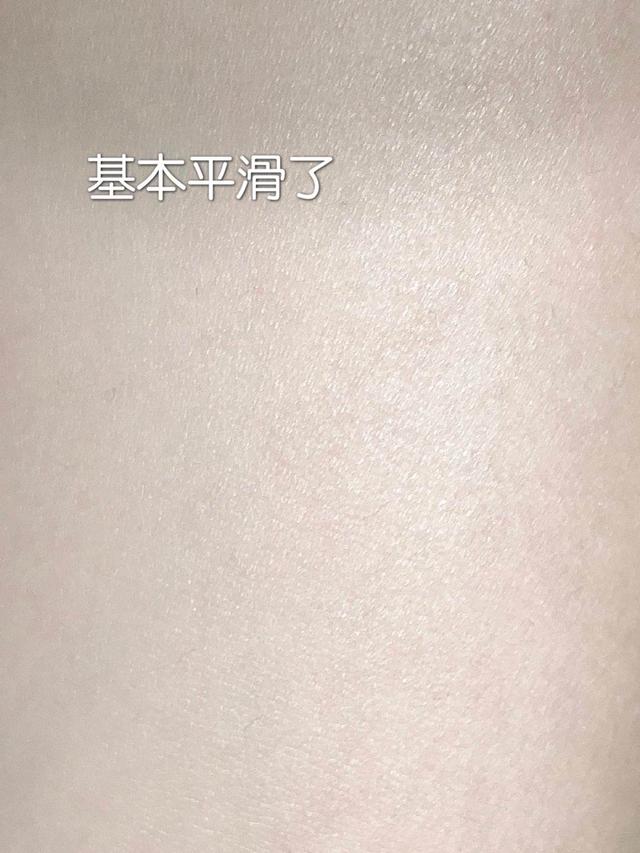 果酸身体乳去闭口