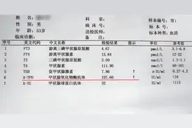 真实案例：碘131治甲亢后出现甲减，整整8年，记忆减退、肢体软乏图片