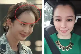 你要洗的不是头发而是头皮！按摩式清洗头皮，连脱发问题都解决了图片