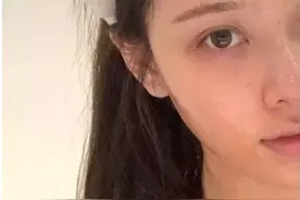 一颗“小鸡蛋”，专门针对皮肤的糖化反应，提亮肤色，紧致肌肤图片