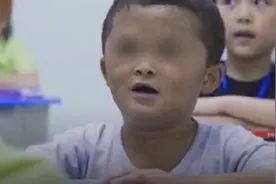 网红“小马云”及其哥哥，被鉴定为智力残疾图片