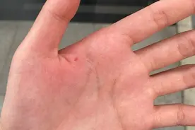 女子逛商场被狗咬伤，狗主人“消失”，商场拒担责图片