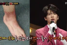 花滑运动员在场上太美了！可你见过他们的脚么？图片