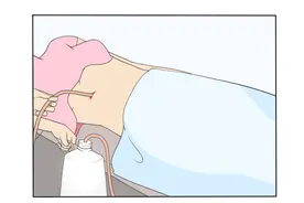 乳腺癌术后出现皮下积液，千万别忽视，可能导致复发转移图片