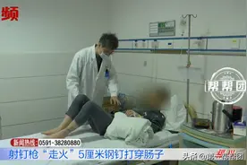 使用射钉枪不慎“走火”，5厘米钢钉打入体内，肠子被戳穿图片