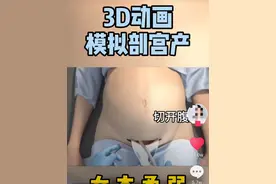 剖宫产有多“伤”妈妈，几张3D过程图带你了解，感恩老婆和妈妈图片