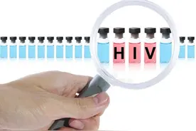 科普 | HIV感染相关的皮肤病多达22种，如何甄别？图片