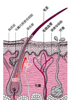 脱毛膏引起毛周角化
