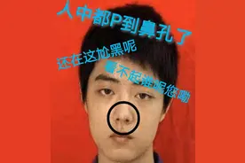 肖战是否整过容？我们用事实说话！图片