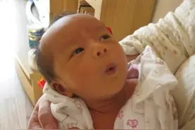 精选问答—十个宝宝八个黄，宝宝黄疸该怎么办？听鲍奶奶怎么说！图片