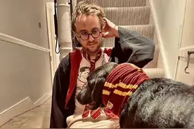 34岁马尔福模仿哈利波特，戴黑框眼镜好像，可发际线后移颜值没了图片