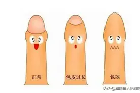 家长带孩子割包皮，提前背熟4点注意事项，就不用再纠结了图片