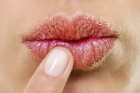 若你的肝不好，嘴部可能会出现这4个现象，你观察过吗？图片
