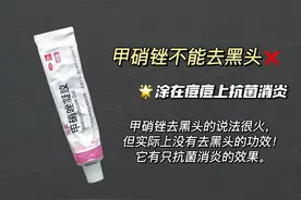 假如去黑头爆品说真话，哪些才是真正有用的？图片
