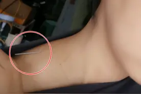 女子从医院回家疼了2小时，衣服下拉发现1根针，她吓得腿软图片