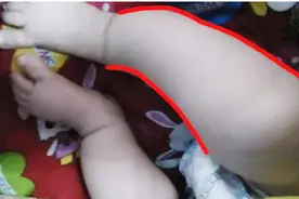 为让“弯腿”变“直腿”，奶奶用绳子将娃五花大绑，网友：太愚昧图片