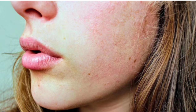 干性皮肤怎么护肤？这份最全的干皮“日常护肤”清单，建议收藏