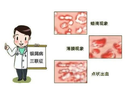 脚上起来好多小红点