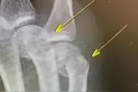 孩子长得矮，发育晚？多半跟这种行为有关，家长要注意避免图片