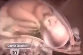 近距离目睹孕妈顺产生娃，一组图演示全过程，每位孕妈都很不容易图片