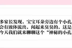 您家宝宝耳朵边有这种神秘的小孔吗？小孔大麻烦，快对照检查图片